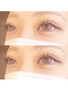 ビューティーホスピタル(Beauty Hospital)/ブラウンmix☆