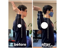 カワル整体 上通り院/【痛みのループから抜け出す】
