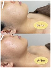 FJ/憧れの小顔へ◇フェイシャル