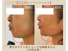 オキシー グレイス 黒崎店(OXY Grace)/インディバフェイシャル