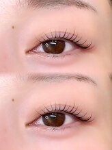 フルール(Fleur)/メーテルロッド