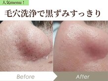 グラシーズ(Glasses)/小鼻の毛穴黒ずみを取り除く！