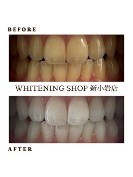 ホワイトニングショップ 新小岩店/歯科提携 ホワイトニング専門店