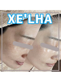 ビーマジック(美magic)/セラピール