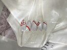 定額Cコース¥9900