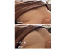 アナパナパ(anapanapa)