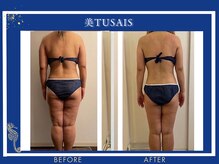 ビテュセスリー はなみずき店(美tusais3)/【痩身・ダイエット】ボディケア