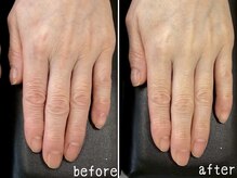 ネイルズ アヴァンティ(Nails Avanti)/ハンドエステ