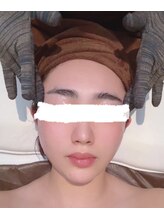 ディベス 仙台卸町本店(DIVES)/フェイシャル