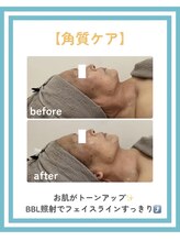 トッコ 清澄白河店(tocco)/BBL