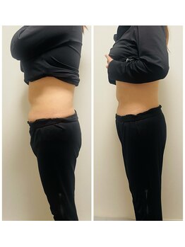 YOSAPARK Lulua/before*after