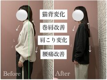 ユルル 刈谷店(Yururu)/変化(骨盤整体＆猫背整体)