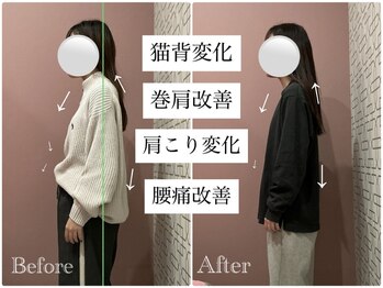 ユルル 刈谷店(Yururu)/変化(骨盤整体＆猫背整体)