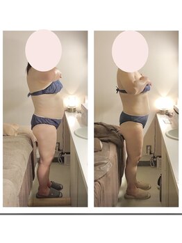アクア エステティコ 亀有(ACQUA estetico)/脂肪燃焼 腹部 50代 4ヶ月経過