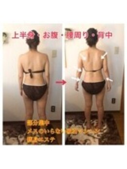 強め筋膜痩身リンパ 小顔エステBAR北野の写真/那覇市希少★強めリンパマッサージを体験できるエステサロン♪リーズナブルな価格で通いやすさ◎
