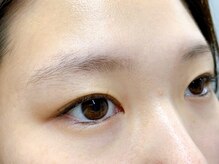 ブロンズアイ(BRONZE EYE)/アイブロウ【施術前】