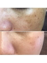 ドルフィン(Dolphin)/★お客様ビフォーアフター