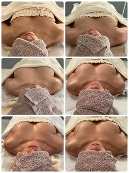 美人バスト 旭川店/バストアップ◇症例◇