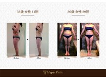 ハンズ鍼灸接骨院小牧院 美容整体ハンズ(美容整体hands)/美容整体 before after