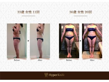 ハンズ鍼灸接骨院小牧院 美容整体ハンズ(美容整体hands)/美容整体 before after