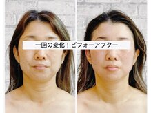 マルカ(MARUKA)/１回で変化！極上エイジングケア