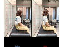 h&h立川駅前の整体院/猫背矯正ビフォーアフター