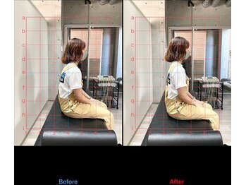 h&h立川駅前の整体院/猫背矯正ビフォーアフター