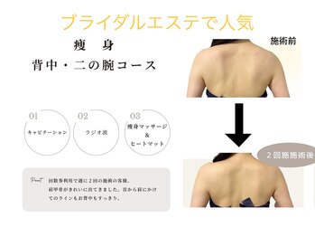 ストック 浦和(Stock)/大人気の背中・二の腕コース