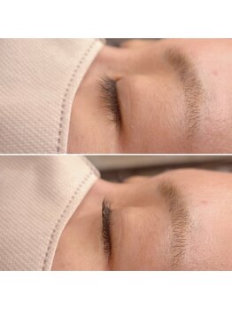 エンジェル(Angel)/マツパ