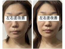 ベルファム(Belle femme)/オリジナル頭蓋骨小顔矯正府中店