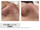 サロン ド ユイ(salon de yui)の写真/【上通×個室】40代からのたるみ毛穴改善！ハイピール×導入で透明感あふれるノーファンデ美肌へ♪