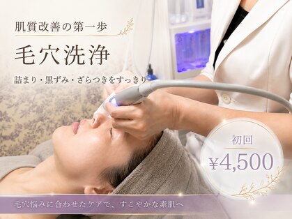 アンヘル(Angel)の写真