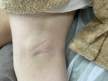 ナノハナ/鹿沼市全身脱毛美容室ナノハナ