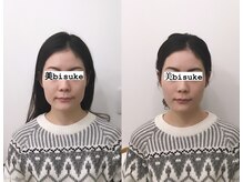 美助(bisuke)/小顔施術１回のお写真