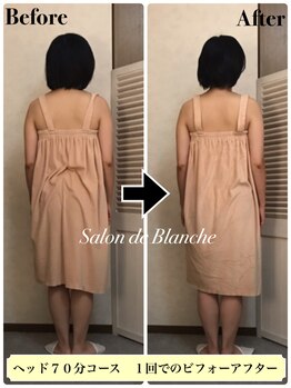 サロン ド ブランシェ(Salon de Blanche)/姿勢矯正できるヘッドマッサージ