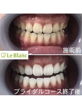 ルブラン 奈良店(Le Blanc)/結婚式やフォトウェディング前に