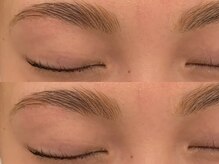 オズ(OZ)/新ハリウッドブロウリフト