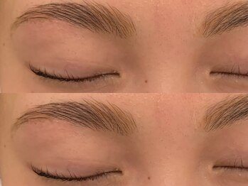 オズ(OZ)/新ハリウッドブロウリフト