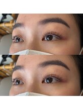 エス('S)/ニュアンスカール　メガCロッド