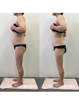 ルクール(Le Couer)/５０代２ヶ月後