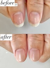 ニコワイズネイル(Nico Y's Nail)/【自爪育成コース】