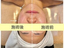 オプレア 栄店(OPREA)の雰囲気（一回で実感！むくみ・輪郭すっきり！）