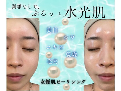 リノ(Lino)の写真