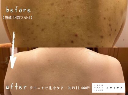 ボウ 名古屋店(VOEUX)の写真