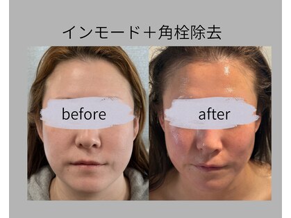 リズ(rE:S)の写真