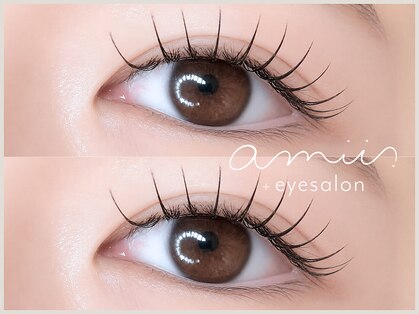 アミー 天神大名店(amii.)の写真