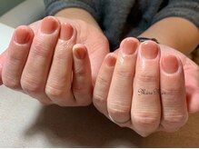 メールメール 和光市本店(MereMer)/深爪矯正にワンカラー