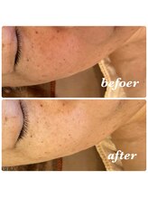 シャルマン(Charmant)/befoer.after