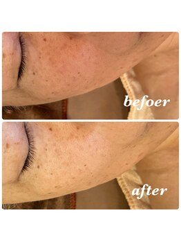 シャルマン(Charmant)/befoer.after