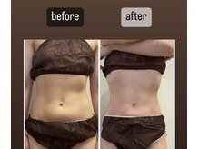 ララ(LALA)/痩身デトックスリンパマッサージ